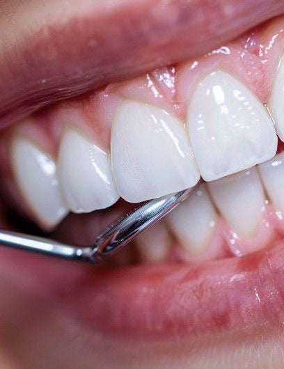 Signs You Might Need a Dental Check-Up