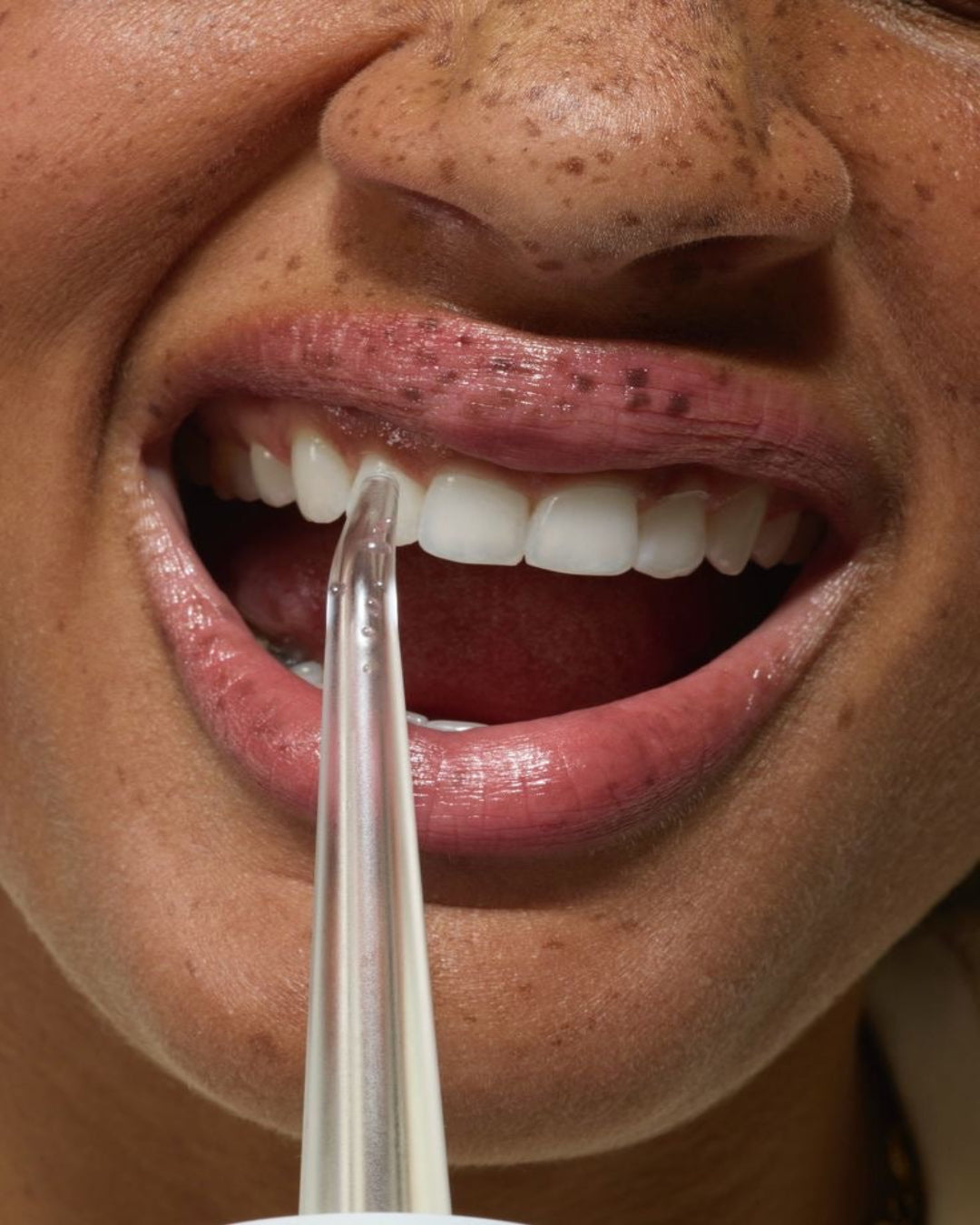 Floss_bild.jpg