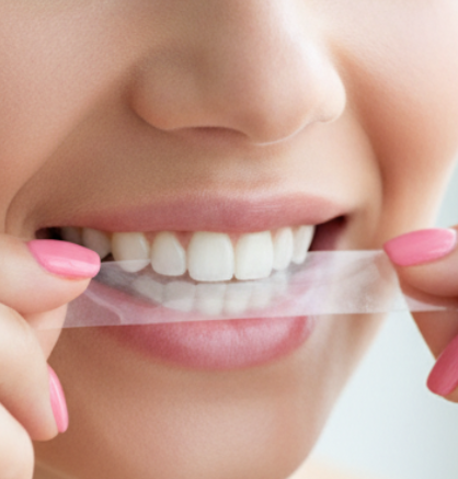 Teeth whitening strips designed for daily use, helping maintain a naturally brighter, healthy-looking smile. Lucent.
