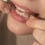 Glow Whitening Strips